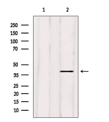 ELAVL2 / HUB Antibody