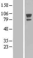AFAP1 / AFAP Protein (Over-Expression Lysate Myc-DDK (Flag))