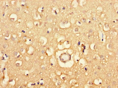 FRA9F Antibody