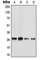 IHC-plus™ BATF2 / SARI Antibody (C-Terminus)