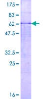 Human MMP23 Protein (Recombinant GST)