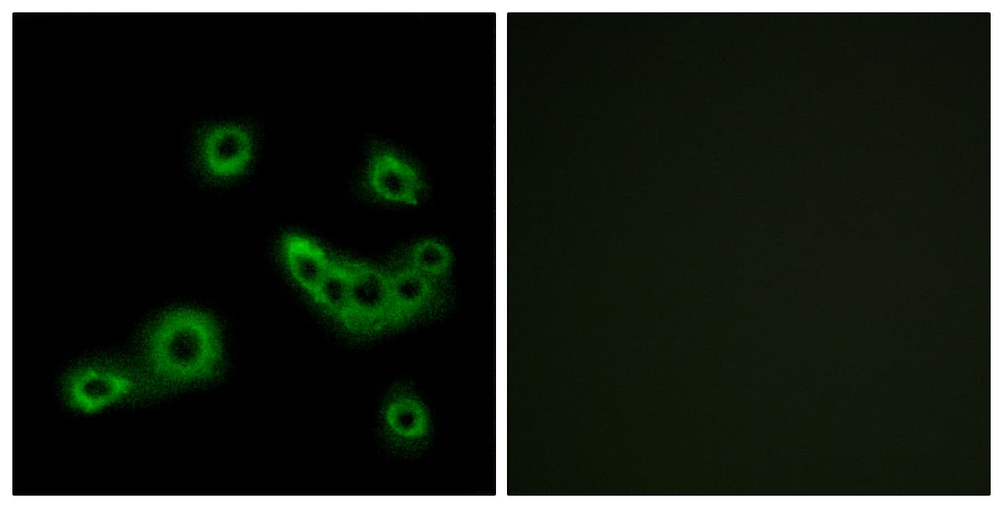 SLC52A1 / GPR172B / PAR2 Antibody (aa235-284)