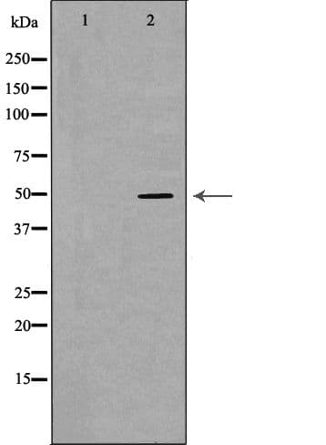 PPARD / PPAR Delta Antibody