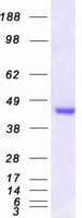 Human MRI1 Protein (Recombinant Myc-DDK (Flag))