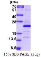 Human MRPS25 Protein (Recombinant His)
