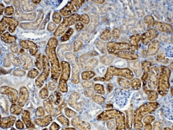 FZD3 / Frizzled 3 Antibody