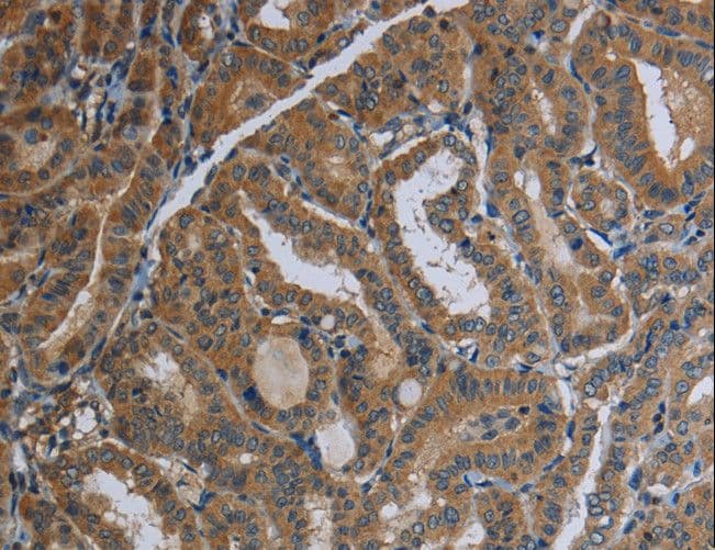 FAAH Antibody