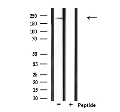 Polyclonal Rabbit anti-Human NAV1 Antibody (WB)