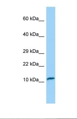 TNNC2 Antibody (aa35-84)