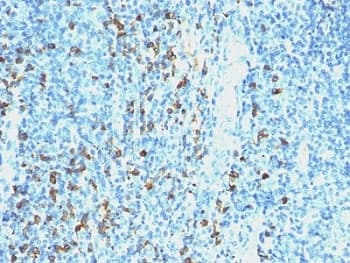 Mouse Anti-Human Lambda Light Chain Secondary Antibody (clone SPM559)