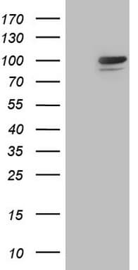 Complement C2 Antibody (aa469-752, clone OTI1A7, Carrier-free)
