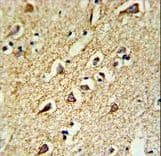 Polyclonal Rabbit anti-Human RPL18A Antibody (aa140-166, IHC, WB)