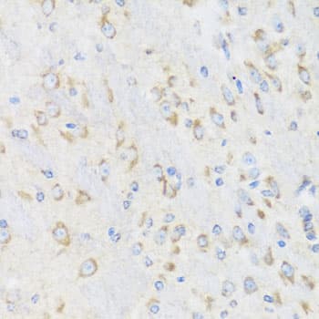 CHIC2 Antibody