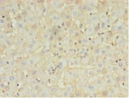 HBB / Hemoglobin Beta Antibody (aa1-147, Biotin)