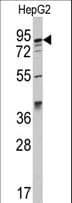 AAK1 Antibody (aa790-819)