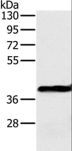 OTC Antibody