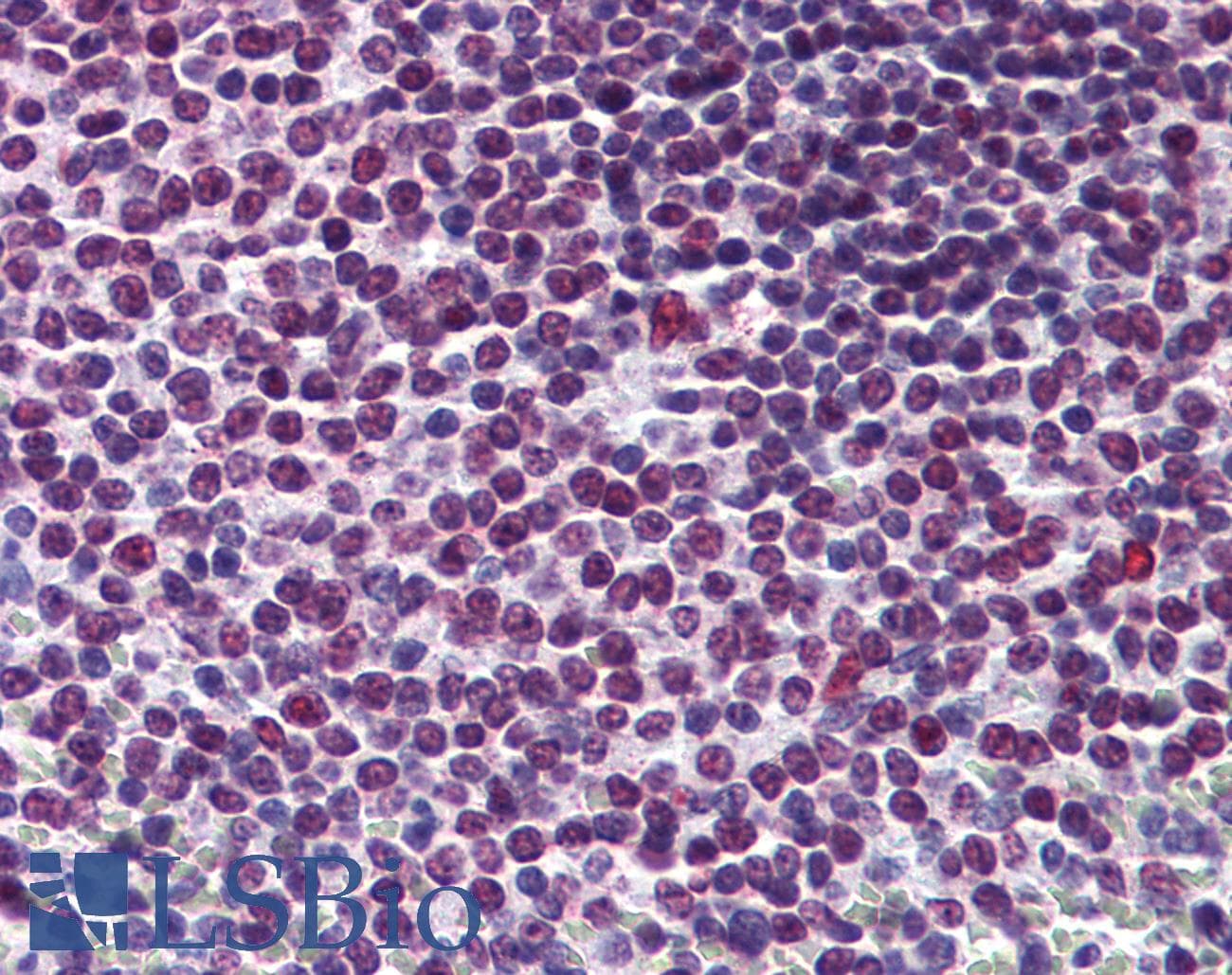 IHC-plus™ Monoclonal Mouse anti-Human RCC1 Antibody (clone 2F1, IHC, IF, WB)