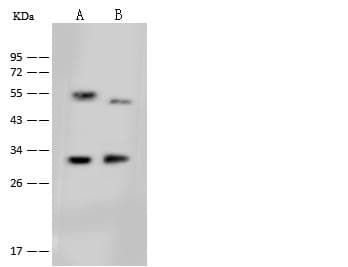 DHRS3 / SDR1 Antibody