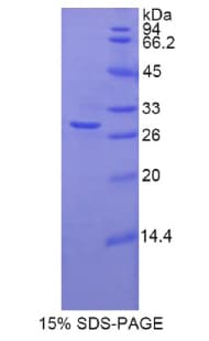 Rat TNNT1 / TNT Protein (Recombinant His)