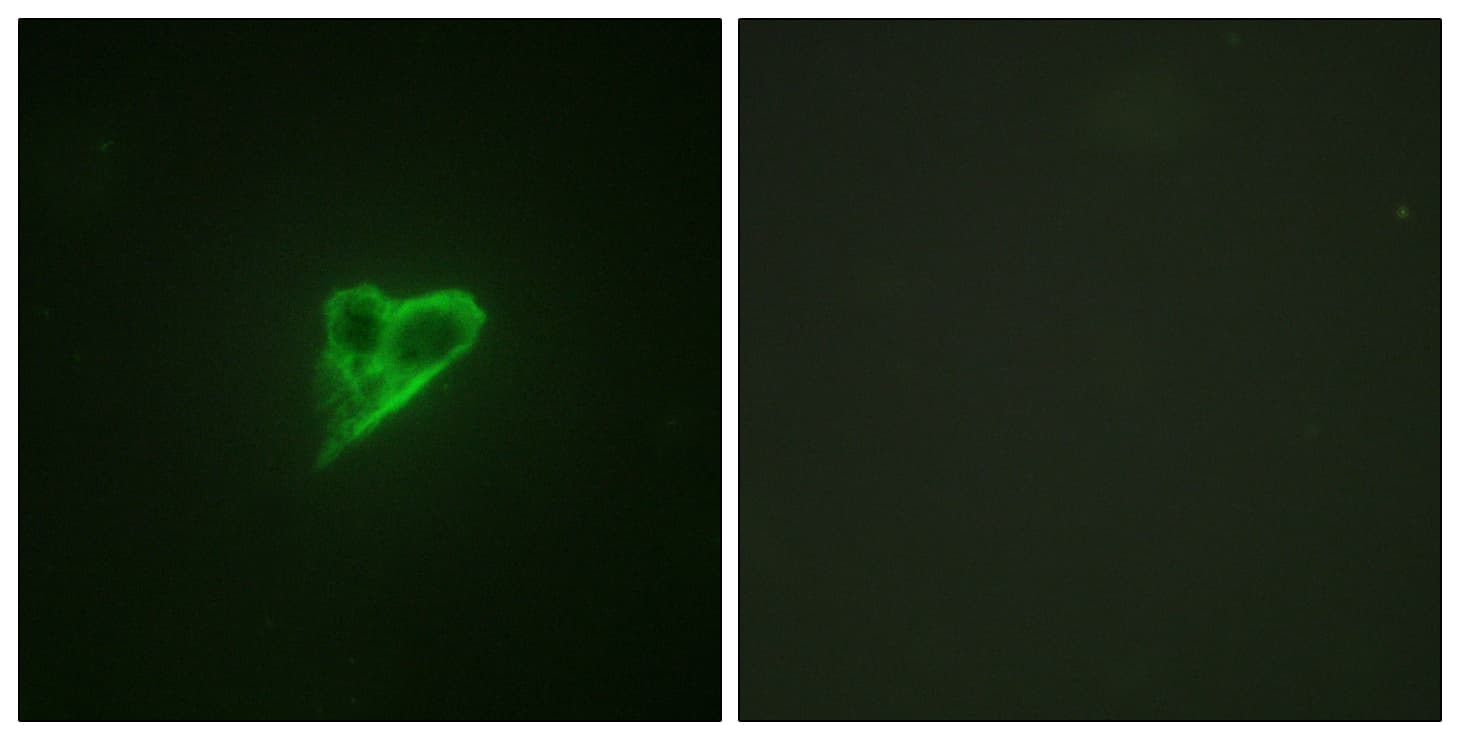 PRKD2 / PKD2 Antibody