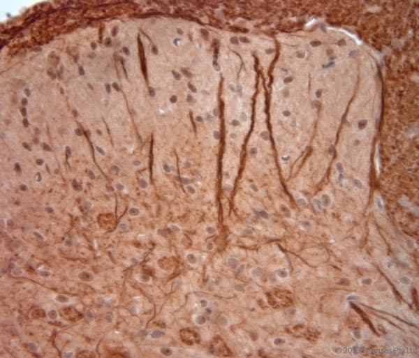 NEFH / NF-H Antibody (aa150-200)