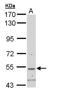 Polyclonal Rabbit anti-Human SNTB2 Antibody (aa174-540, IHC, WB)