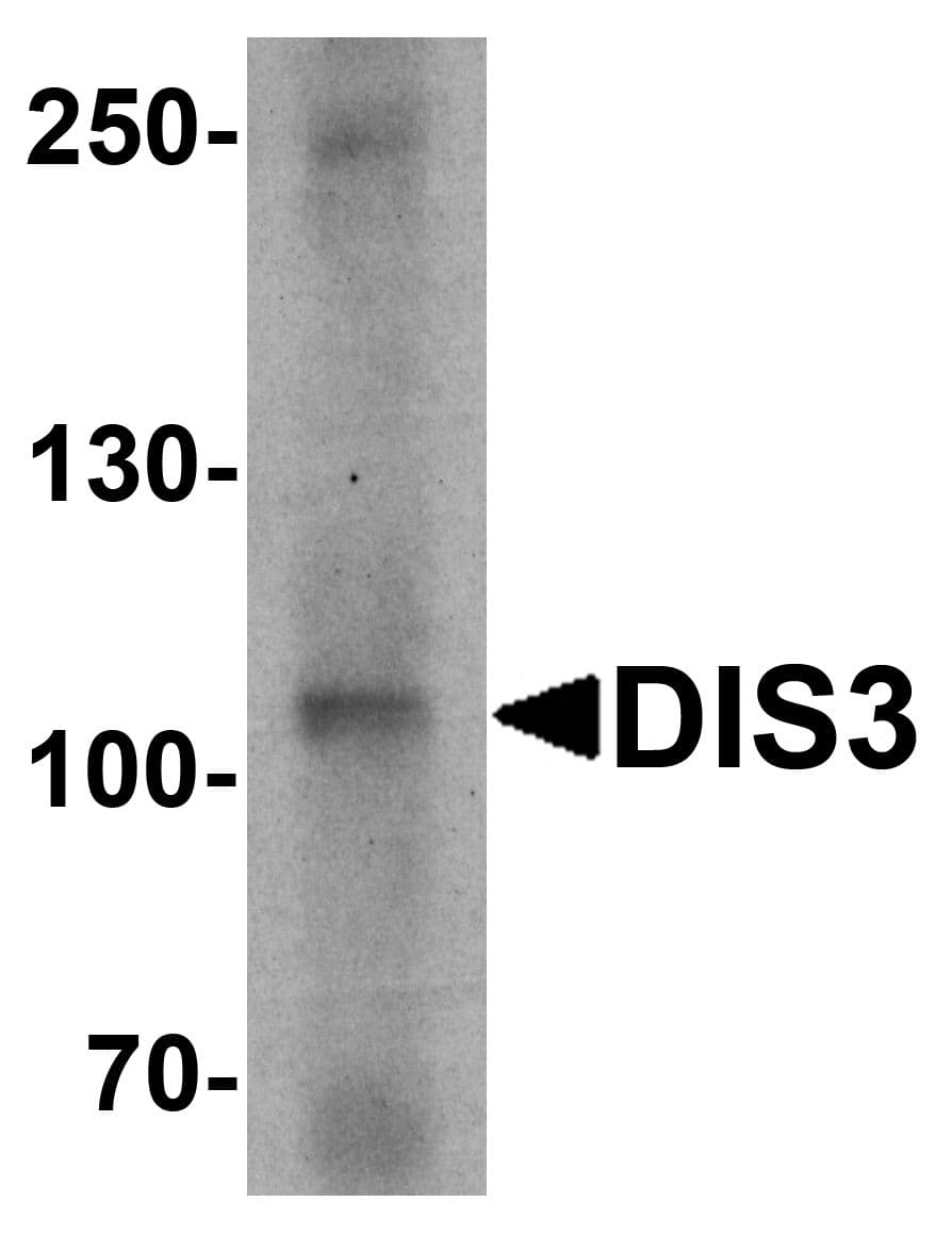 IHC-plus™ DIS3 Antibody