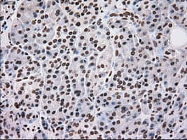 SCYL3 Antibody (clone OTI1A5)