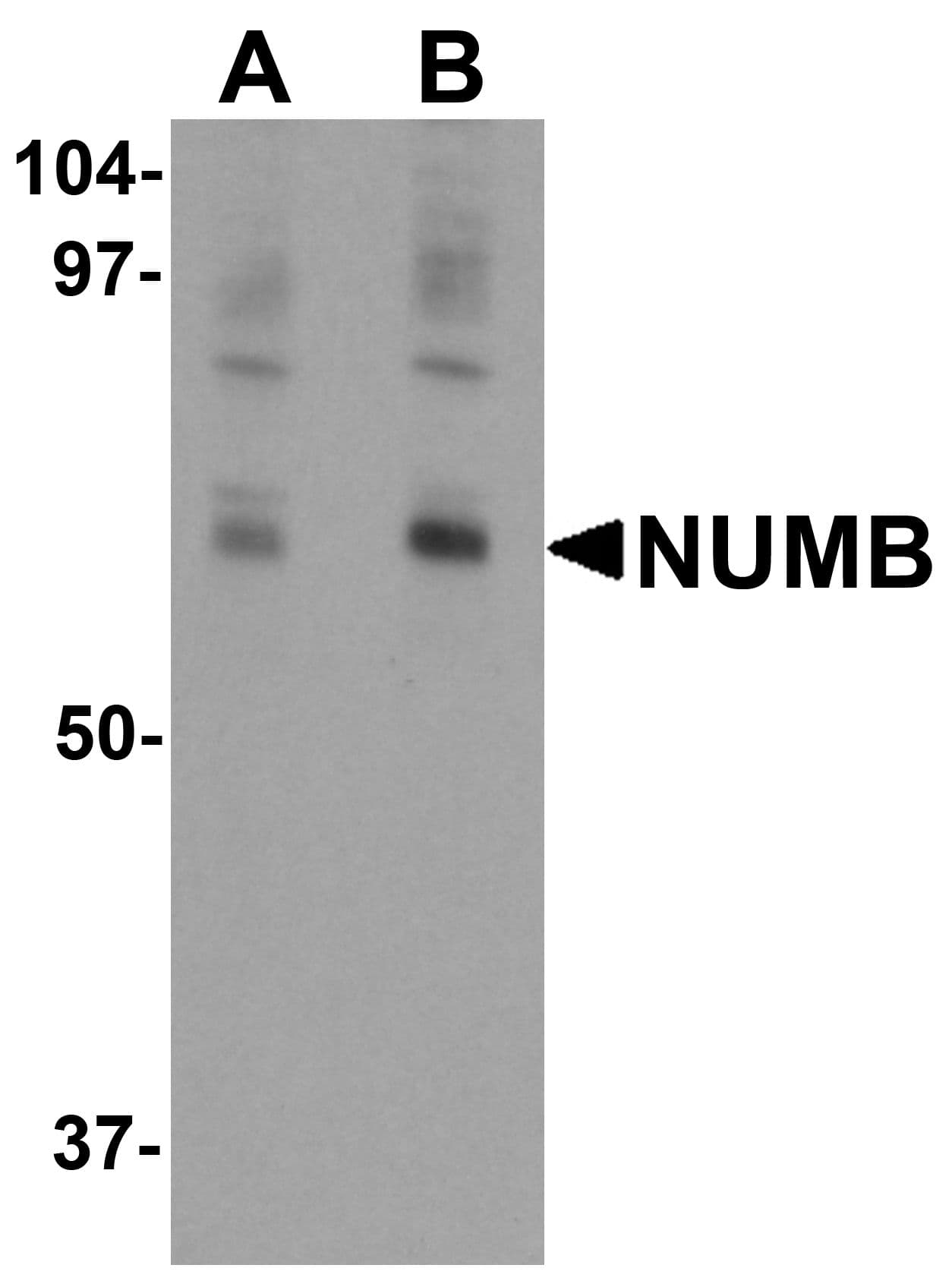 IHC-plus™ NUMB Antibody