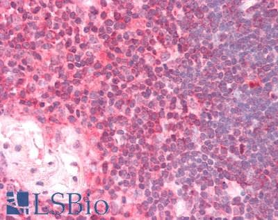 IHC-plus™ Polyclonal Goat anti-Human DDX6 Antibody (aa471-483, IHC, WB)