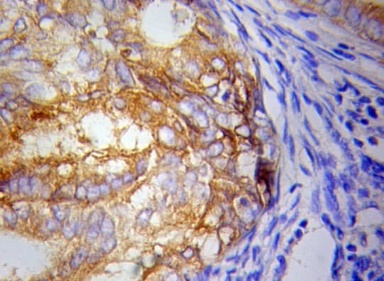 Polyclonal Rabbit anti-Human IKBKE / IKKI / IKKE Antibody (IHC, WB)