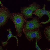 RAB25 Antibody (clone 3F12)