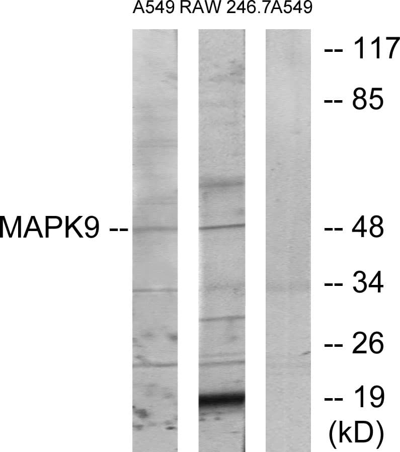 MAPK9 / JNK2 Antibody (aa246-295)