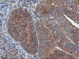 ILVBL Antibody (clone OTI8B12)