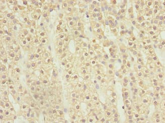 Polyclonal Rabbit anti-Human RASSF5 / RAPL Antibody (IHC, WB)