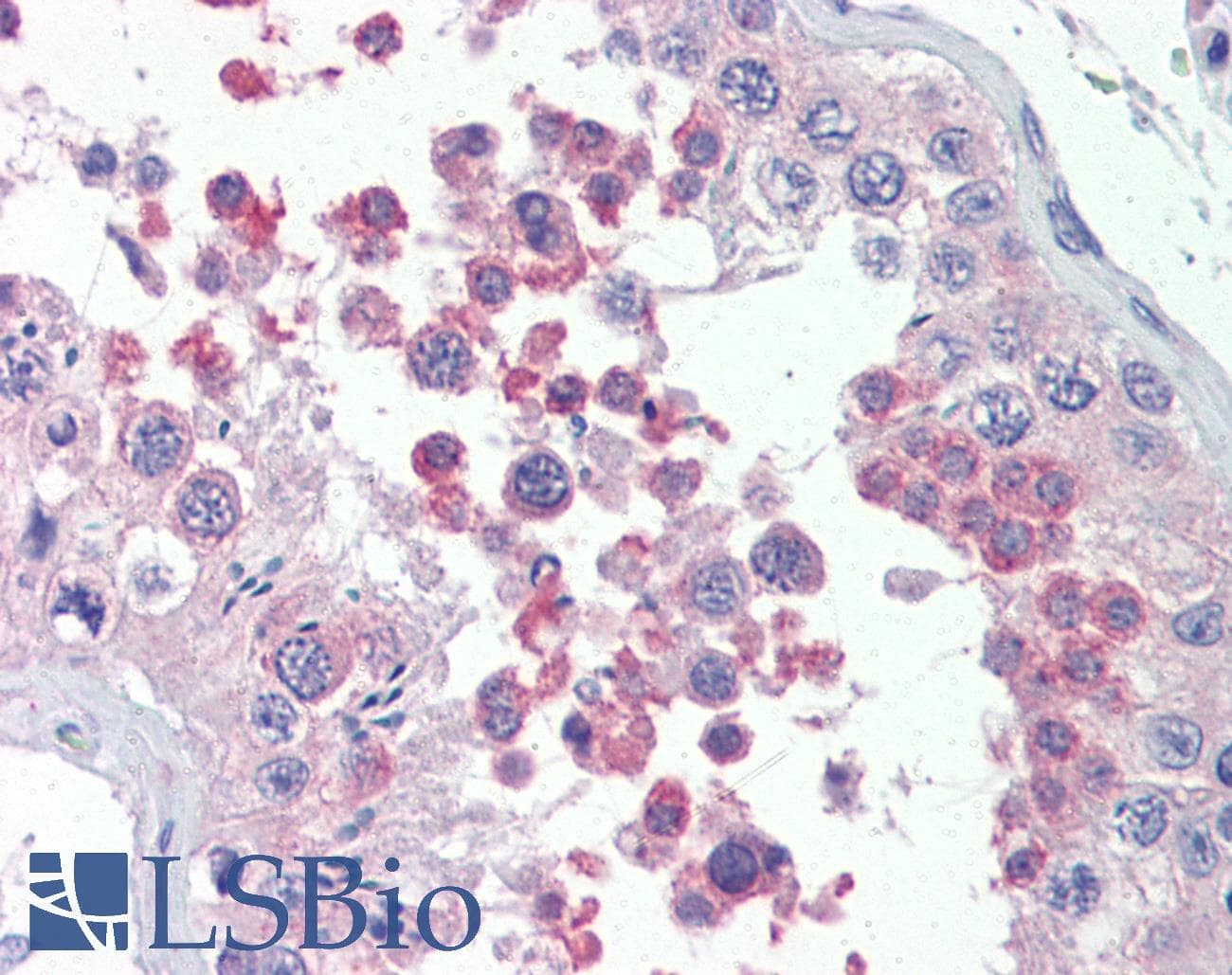 IHC-plus™ Polyclonal Goat anti-Human KMT2B / MLL4 Antibody (aa2703-2715, IHC)