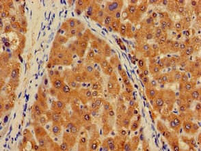 Polyclonal Rabbit anti-Human PLXND1 / Plexin D1 Antibody (IHC, IF)
