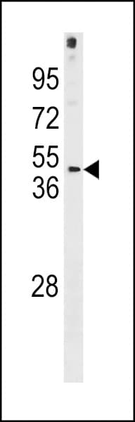 Polyclonal Rabbit anti-Human FRA10AC1 Antibody (aa253-280, WB)