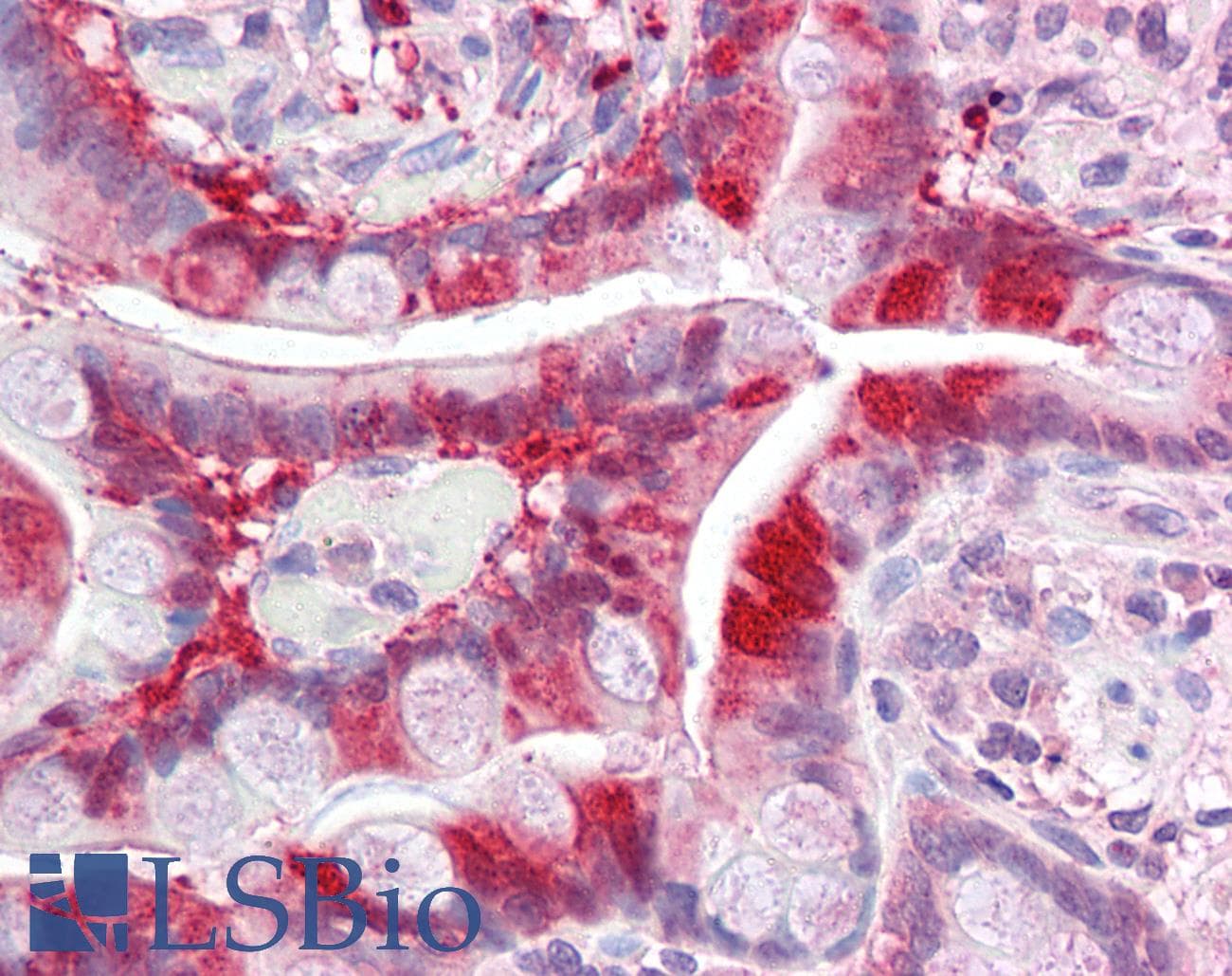 PCA1 / ALKBH3 Antibody (aa216-265)