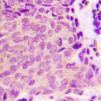 Tuberin / TSC2 Antibody (phospho-Ser939)