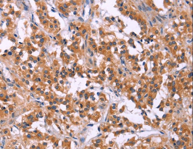 Polyclonal Rabbit anti-Human SC4MOL Antibody (IHC)