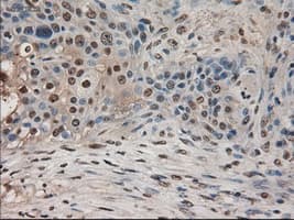 AMY2A / Pancreatic Amylase Antibody (clone OTI6D4)