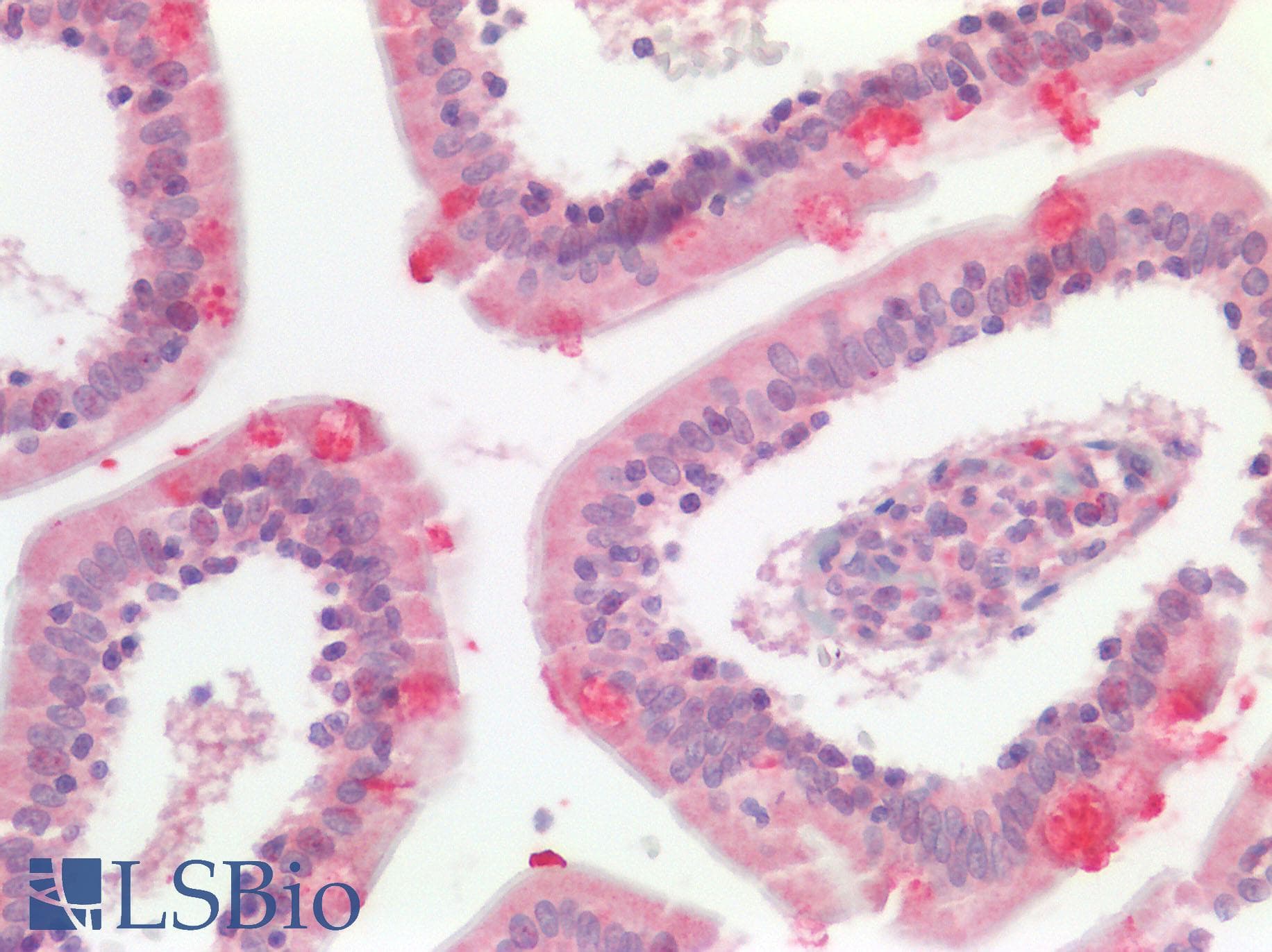PathPlus™ Polyclonal Rabbit anti-Human GPR49 / LGR5 Antibody (Cytoplasmic Domain, IHC, IF)
