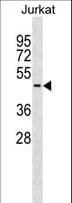 Polyclonal Rabbit anti-Human SERPINB8 Antibody (aa274-301, WB)