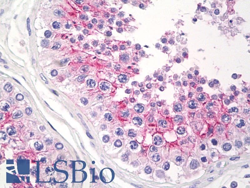 IHC-plus™ Basigin / Emmprin / CD147 Antibody (clone 56.3_1D5)