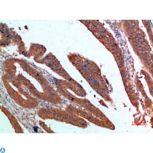 Polyclonal Rabbit anti-Human PDGF-CC Antibody (IHC)