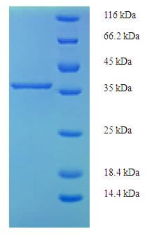 Human PIGX Protein (Recombinant His-SUMO)