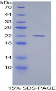 Mouse ACO1 / Aconitase Protein (Recombinant His)
