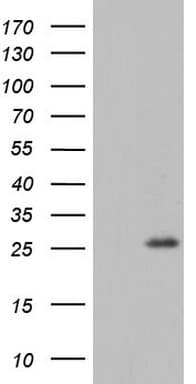 RSPO1 / RSPO Antibody (aa21-263, clone OTI2F10)
