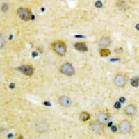 Polyclonal Rabbit anti-Human MAP3K7 / TAK1 Antibody (phospho-Thr187, IHC, WB)